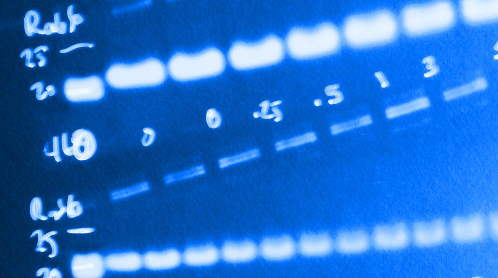 عکس رنگی از نتیجه تست وسترن بلات. نرم افزارهای Proofig و image Twin به تحلیل داده های تصویری Western blot برای کشف تقلب در مقالات دانشگاهی  کمک می کنند.