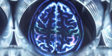 یک شبکه مغزی بزرگ در بیماران مبتلا به افسردگی کشف شد