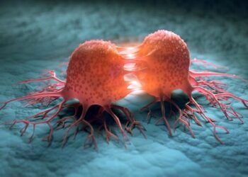 تشخیص هوشمند سرطان پروستات با یک اپلیکیشن ایرانی