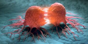 تشخیص هوشمند سرطان پروستات با یک اپلیکیشن ایرانی