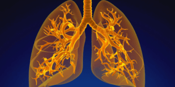 تأثیر BMI غیرطبیعی در کودکی بر عملکرد ریه در بزرگسالی