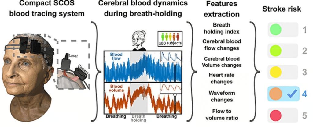 با این دستگاه جدید خطر سکته مغزی به صورت غیر تهاجمی شناسایی می شود
