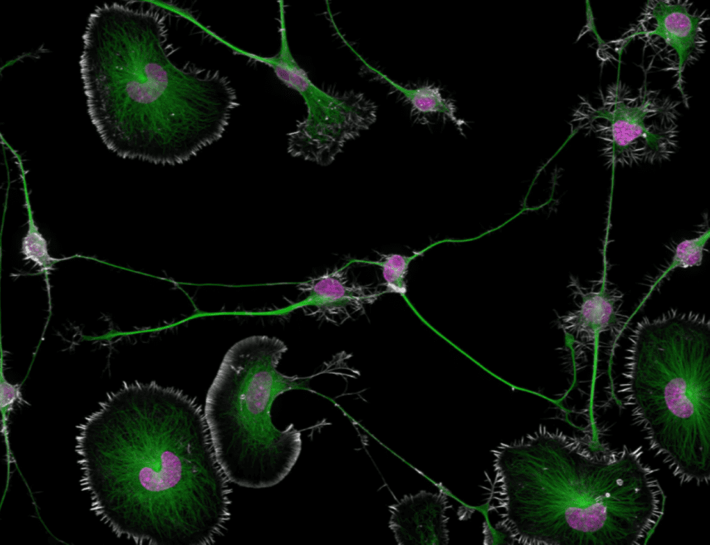 تصویر  Differentiated mouse brain tumor cells، نخستین برنده مسابقه مسابقه Nikon Small World 2024 