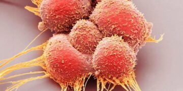 کلید جلوگیری از سرطان پروستات کشف شد