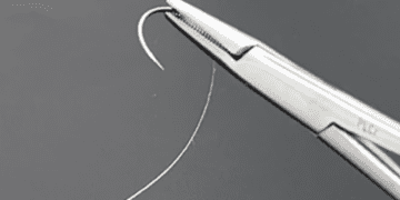 انقلاب در بهبود زخم‌ با بخیه‌های هوشمند الکتریکی