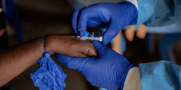 اولین کیت تست تشخیص ویروس آبله میمونی تأیید شد