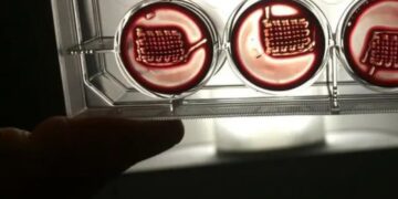 استفاده از خون برای ترمیم بهتر زخم‌های بدن