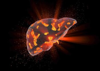 دو نوع جدید از بیماری کبد چرب شناسایی شد