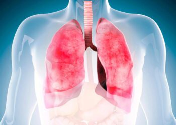 این ماده در شربت‌های سرفه فیبروز ریوی را درمان می کند