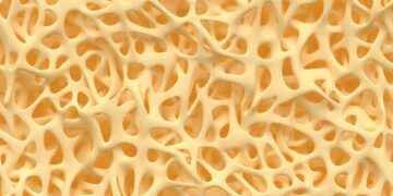 ابداع یک هیدروژل جدید برای بازسازی استخوان