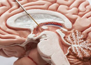 درمان نوآورانه پارکینسون با نانوذرات