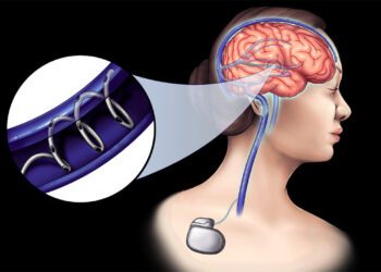 استارتاپ NeuroBionics: انقلابی در درمان بیماری‌های عصبی با فناوری نوین زیست‌الکتریکی