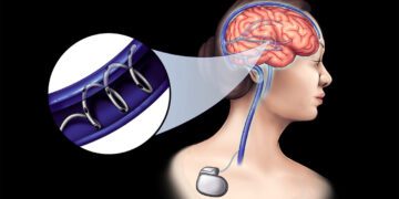 استارتاپ NeuroBionics: انقلابی در درمان بیماری‌های عصبی با فناوری نوین زیست‌الکتریکی