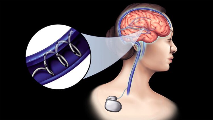 استارتاپ NeuroBionics: انقلابی در درمان بیماری‌های عصبی با فناوری نوین زیست‌الکتریکی