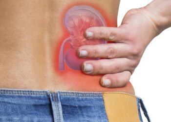 این علائم می گویند شما دچار سنگ کلیه شده اید