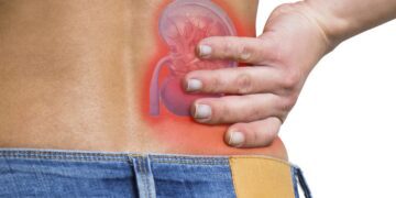 این علائم می گویند شما دچار سنگ کلیه شده اید