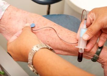 تشخیص دقیق بیماری آلزایمر با یک آزمایش خون ساده