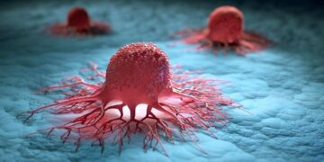 ایران به کشورهای پیشرو در فناوری تشخیص سرطان پیوست