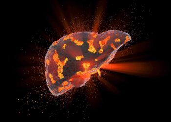 نقش یک مکمل ورزشی در بهبود سیروز کبدی آزمایش می شود