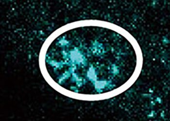 میکروپلاستیک‌ها می‌توانند جریان خون مغز را مختل کنند