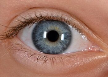 تاثیر سطوح بالای کلسترول مفید بر افزایش ابتلا به بیماری آب سیاه چشم