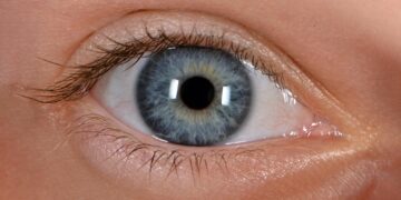 تاثیر سطوح بالای کلسترول مفید بر افزایش ابتلا به بیماری آب سیاه چشم