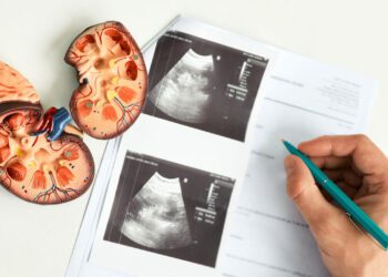 تحولی عظیم در درمان سرطان کلیه با واکسن های اختصاصی