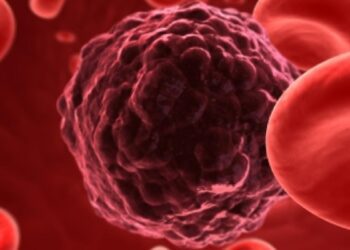 کدام سرطان ها بیشترین میزان مرگ و میر را دارند؟