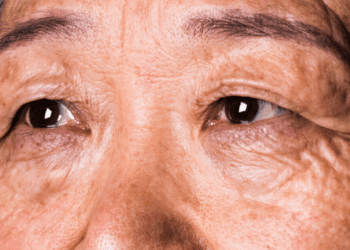 مشکلات بینایی شاید نشانه‌های اولیه زوال عقل باشند