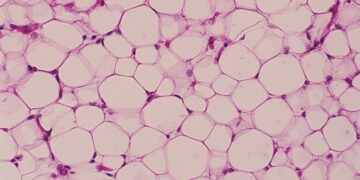 دانشمندان نوع جدیدی از سلول‌های چربی را کشف کردند