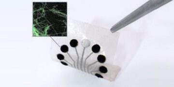 نظارت بر فرایندهای زیستی بدن با حسگرهای نوآورانه