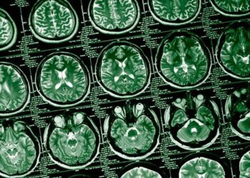 کشف ناهنجاری‌ های پنهان در عملکرد مغز سربازان