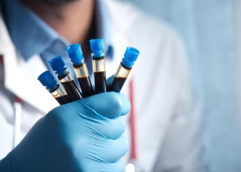 آزمایش خون جدید تشخیص آلزایمر با دقت ۹۲ درصدی