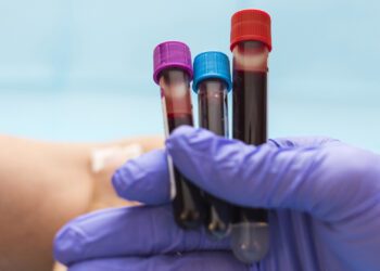 توسعه آزمایش خون پیشرفته برای تشخیص بیماریهای ژنتیکی نادر در کودکان