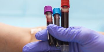 توسعه آزمایش خون پیشرفته برای تشخیص بیماری‌های ژنتیکی نادر در کودکان