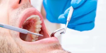 بیماری لثه با یکی از بیماری ‌های رایج قلبی ارتباط دارد!