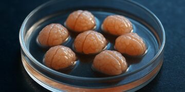 کشف رازهای بیماری آلزایمر با استفاده از بافت زنده مغز انسان