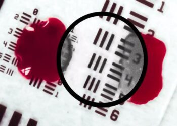 شفاف‌سازی خون هنگام جراحی با فناوری مبتنی بر هوش مصنوعی