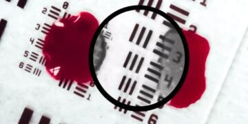 شفاف‌سازی خون هنگام جراحی با فناوری مبتنی بر هوش مصنوعی