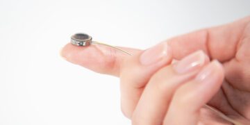 آزمایش بالینی موفق نخستین ایمپلنت مغزی رقیب نورالینک