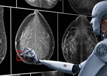 هوش مصنوعی دقت رادیولوژیست ها را در تشخیص سرطان پستان افزایش می دهد