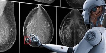 هوش مصنوعی دقت رادیولوژیست‌ ها را در تشخیص سرطان پستان افزایش می ‌دهد