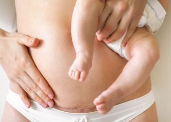 سزارین برنامه‌ریزی شده ممکن است خطر ابتلا به سرطان خون را در کودکان افزایش دهد