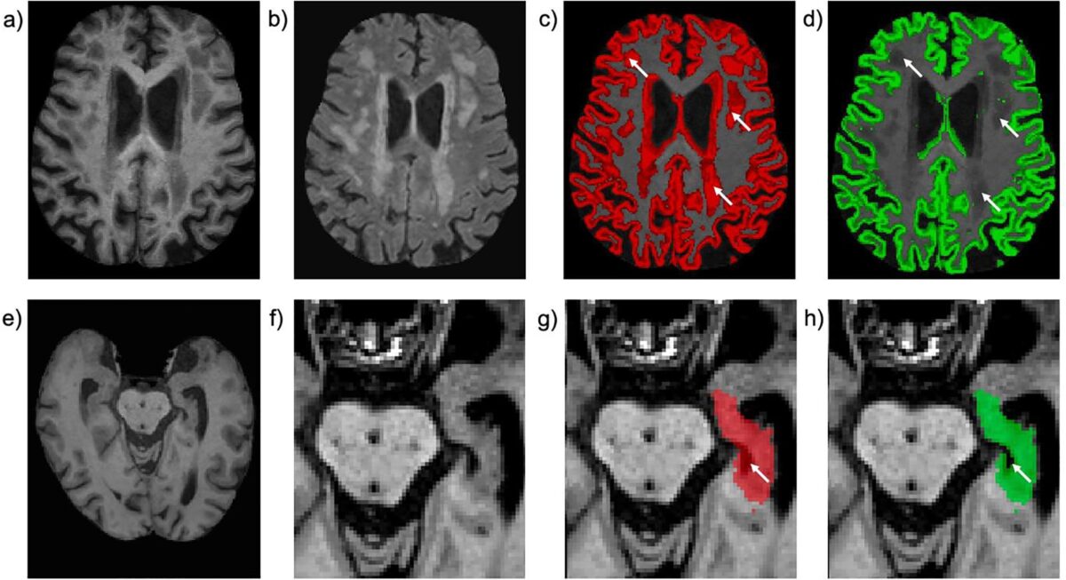 کامل‌ترین پروژه جهانی برای تصویربرداری بدن انسان تکمیل شد 