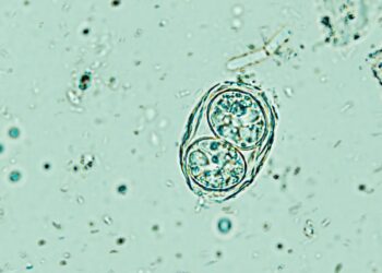 انگل خطرناک توکسوپلاسما گوندی مغز انسان را تحت تأثیر قرار می دهد