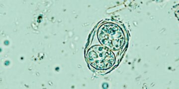 انگل خطرناک توکسوپلاسما گوندی مغز انسان را تحت تأثیر قرار می ‌دهد