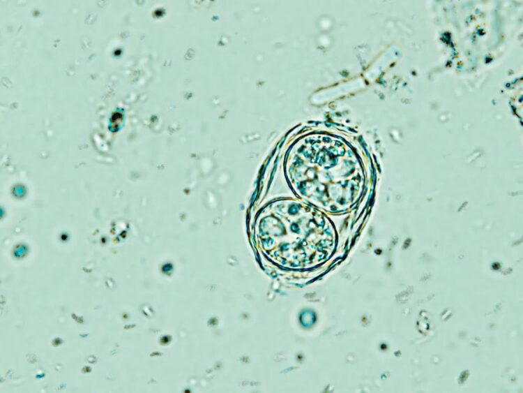 انگل خطرناک توکسوپلاسما گوندی مغز انسان را تحت تأثیر قرار می ‌دهد