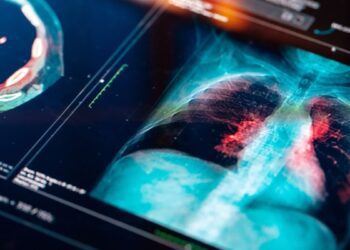 ۱۰ سرطان کشنده جهان بر اساس آمار بقا