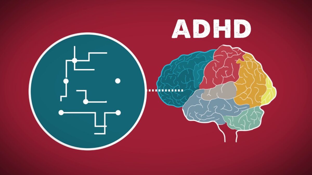 تفاوت در ساختار مغز افراد مبتلا به ADHD