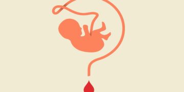 ذخیره ۲۵۰ هزار نمونه خون بندناف در ایران